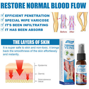 Veins Treatment Spray